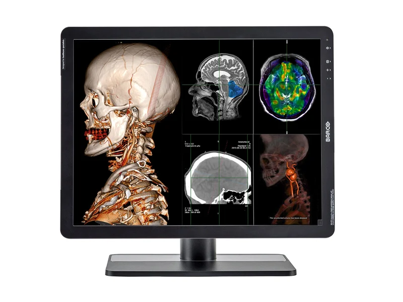 Barco Eonis MDRC-2221 2MP 21" Color Clinical Review Display Monitor