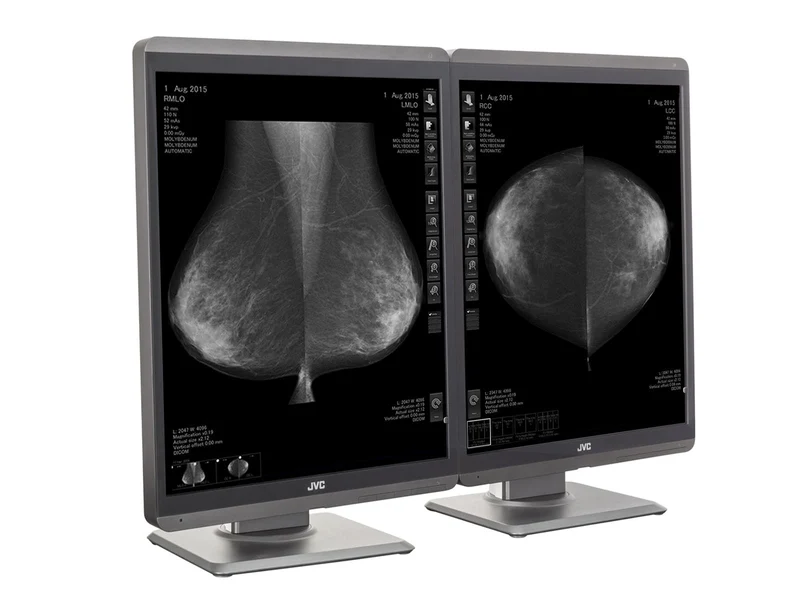 JVC Totoku MS-S500 5MP 21" Mammo 3D-DBT Grayscale Breast Imaging Display (MS-S500)