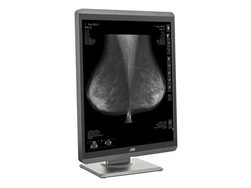 JVC Totoku MS-S500 5MP 21" Mammo 3D-DBT Grayscale Breast Imaging Display (MS-S500)