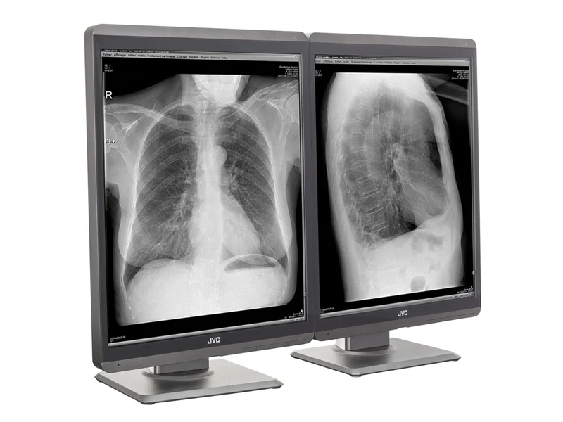 JVC Totoku MS-S300 3MP 21" Grayscale General Radiology Diagnostic Display Monitor (MS-S300)