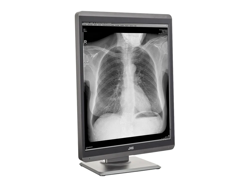 JVC Totoku MS-S300 3MP 21" Grayscale General Radiology Diagnostic Display Monitor (MS-S300)