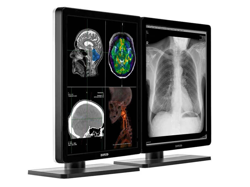 Barco Nio MDNC-2221 2MP 21" Color Diagnostic Radiology Display Monitor