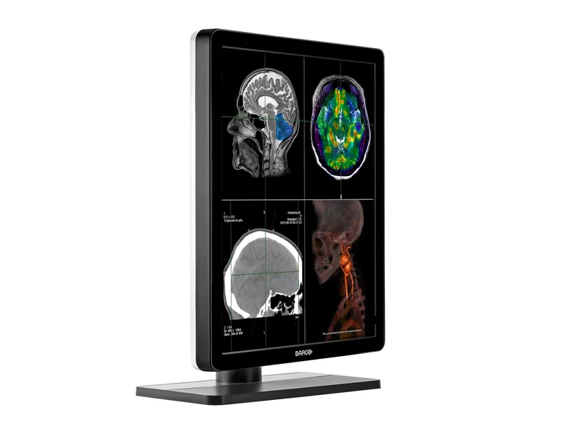 Barco Nio MDNC-2221 2MP 21" Color Diagnostic Radiology Display Monitor