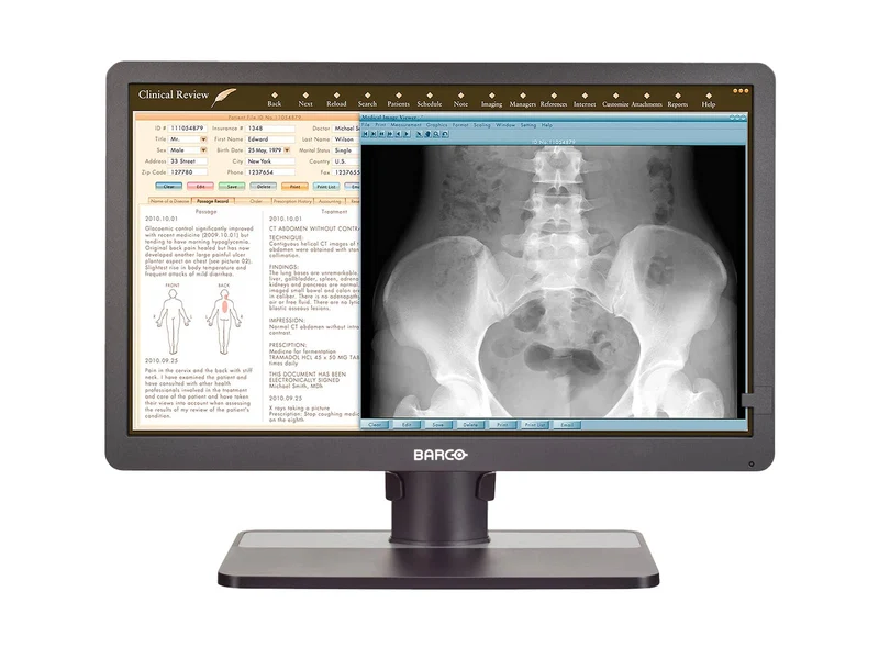Barco Eonis MDRC-2324 SNIB 2MP 24" Clinical Review Monitor