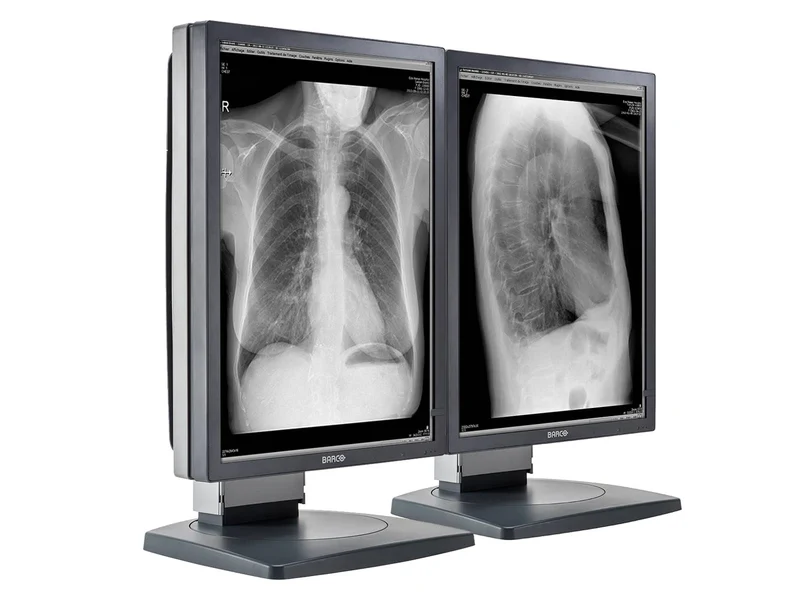 Barco Coronis MDCG-3120 3MP 20.8" Grayscale General Radiology Diagnostic Display