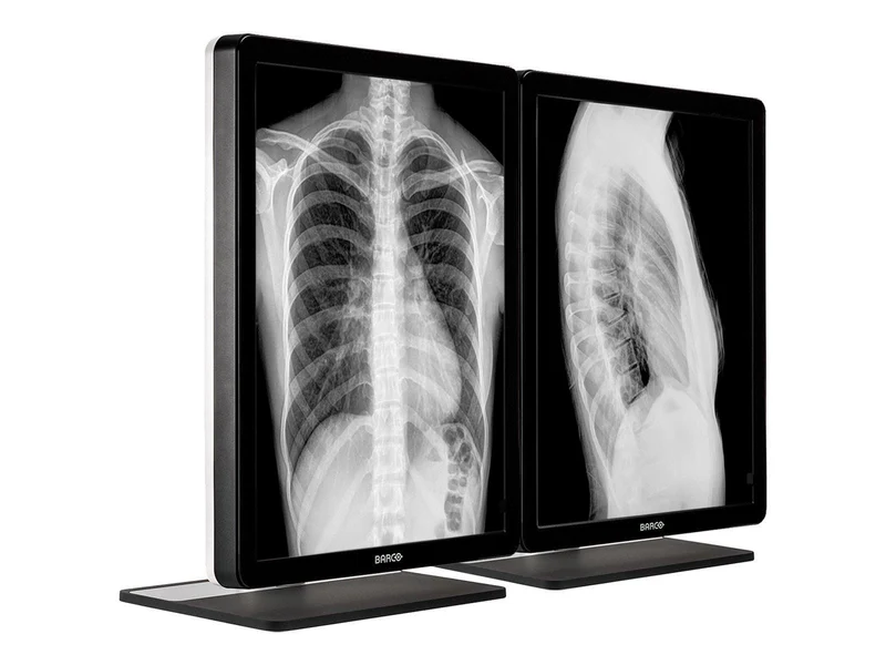 Barco Coronis MDCG-3221 3MP 21" Grayscale General Radiology Diagnostic Display