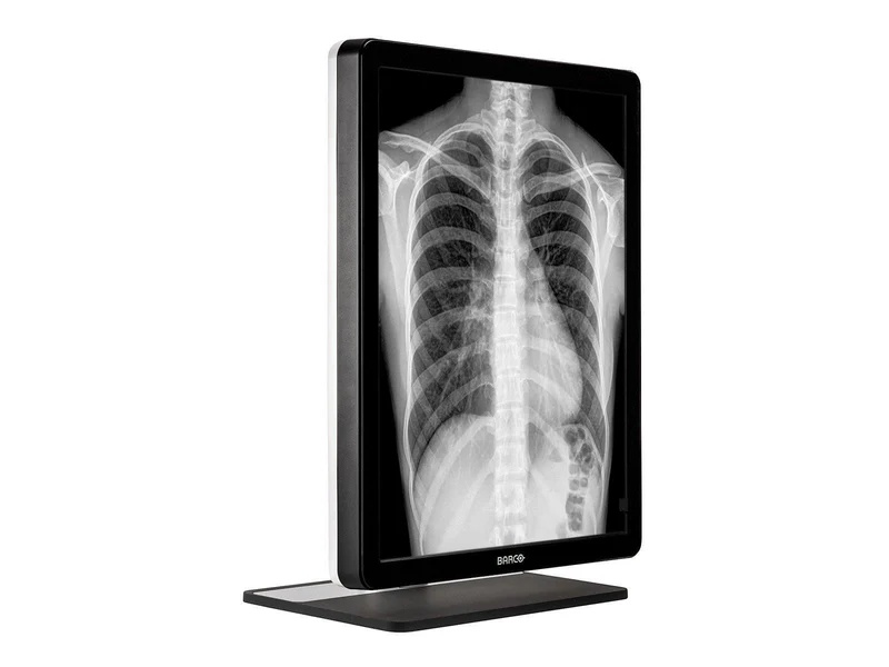 Barco Coronis MDCG-3221 3MP 21" Grayscale General Radiology Diagnostic Display