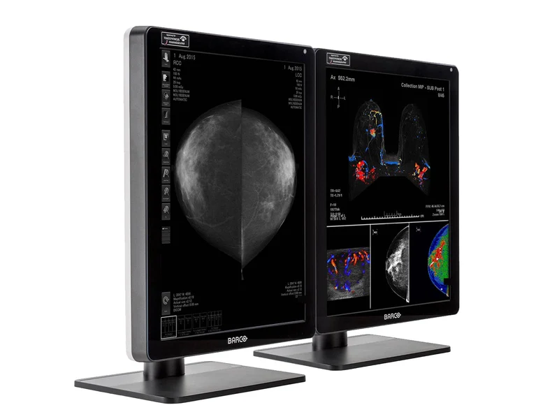 Barco Nio MDNC-6121 5MP 21" Color Mammo 3D-DBT Breast Imaging Display