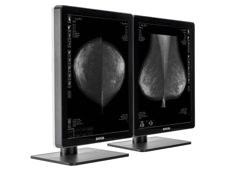 Barco Nio MDNG-5221 5MP 21" Grayscale 3D-DBT Mammography Breast Imaging PACS Display