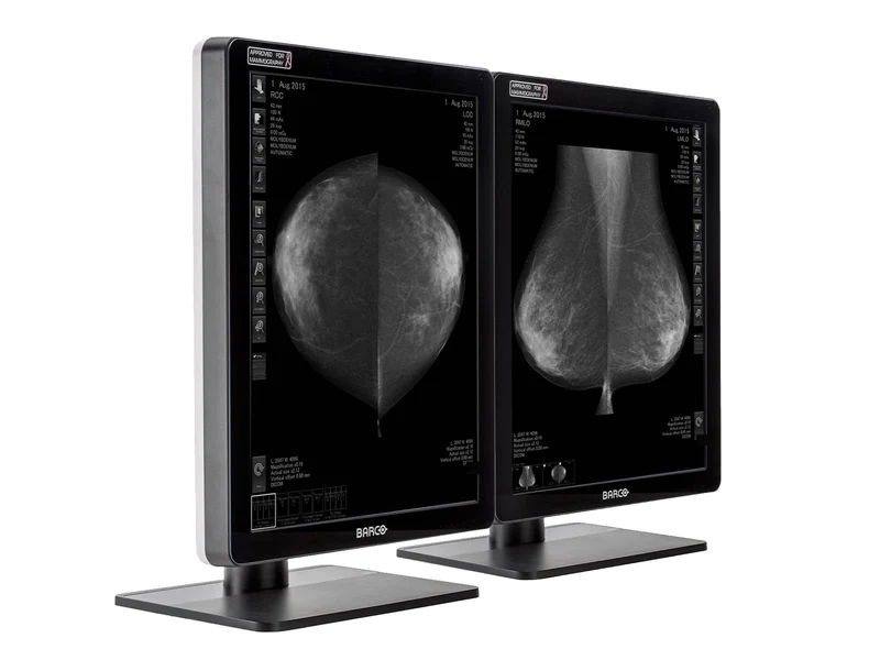 Barco Coronis MDCG-5221 5MP 21" Grayscale Mammo 3D-DBT Breast Imaging Display