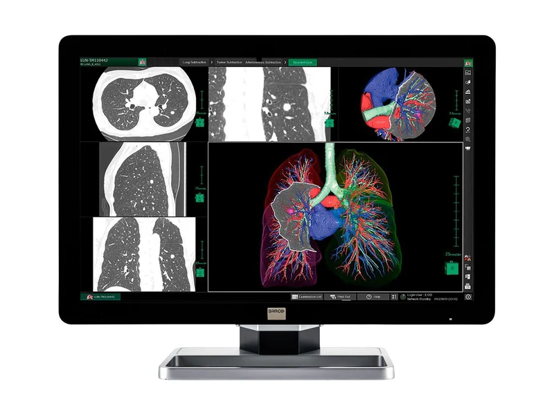 Barco Coronis Fusion MDCC-6330 6MP 30" Color General Radiology PACS Display