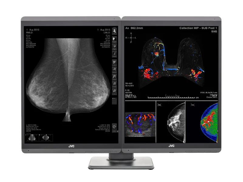 JVC Totoku CL-S500 5MP 21" Color Mammo 3D-DBT Breast Imaging Display (CL-S500)