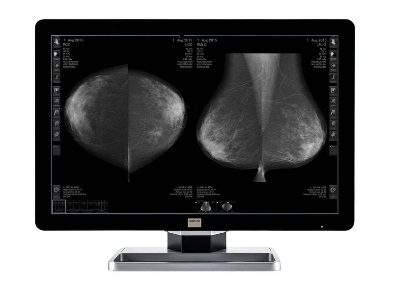Barco Coronis Fusion MDCG-10130 10MP 30" Grayscale Mammo 3D-DBT Breast Imaging Display