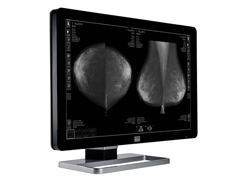Barco Coronis Fusion MDCG-10130 10MP 30" Grayscale Mammo 3D-DBT Breast Imaging Display