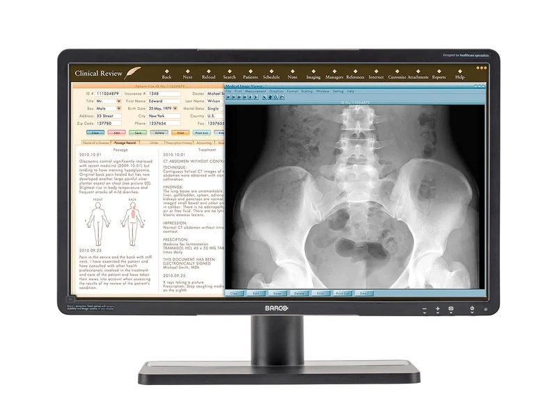 Barco Eonis MDRC-2224 WUXGA 24" 2MP Color Clinical Review Display Monitor