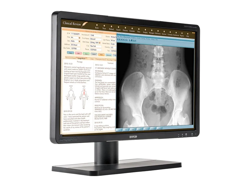 Barco Eonis MDRC-2224 WUXGA 24" 2MP Color Clinical Review Display Monitor
