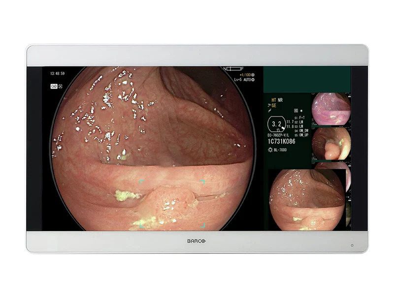 Barco MDSC-8331 LED ISM 31” 8MP 4K UHD Surgical Medical Display Monitor (991932399111)