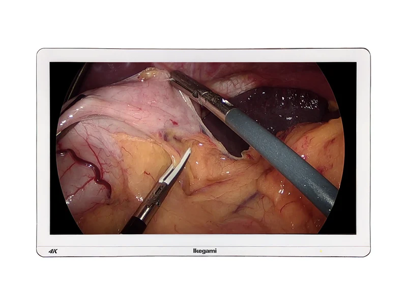 Ikegami MLW-2750UHD 27" 4K Surgical Display Monitor (MLW-2750UHD)