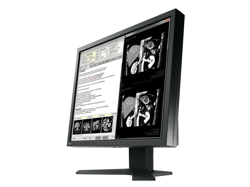 Eizo RadiForce MX192 1MP 19" Color LCD Clinical Review Monitor (0FTD2046)