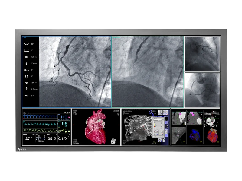 Eizo RadiForce LS560W 56" 8MP 4K Surgical Medical Display Monitor (LS560W)