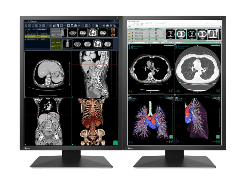 Eizo RadiForce RX270 2MP 21" Color Medical Diagnostic Radiology Display Monitor (RX270-BK)