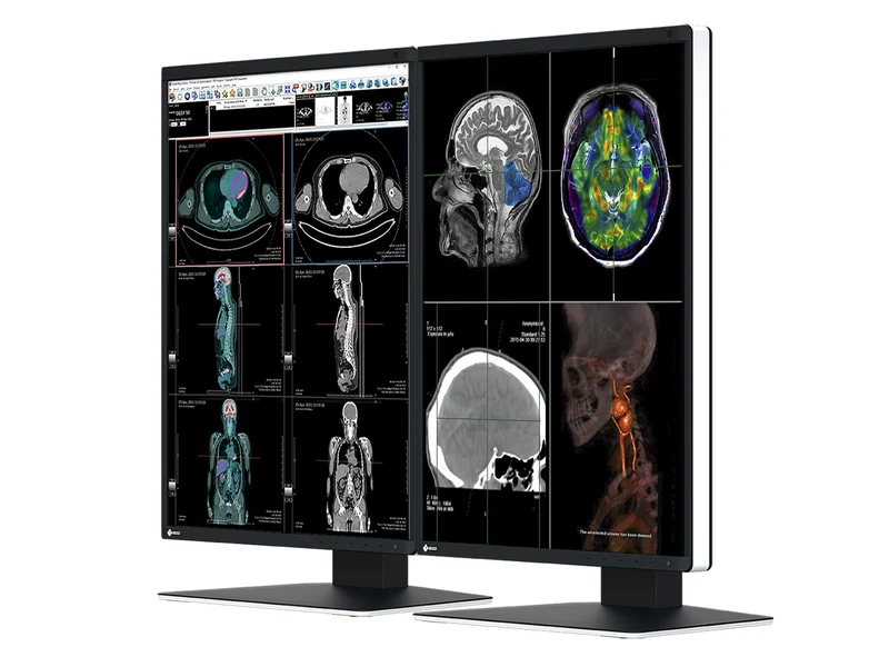Eizo RadiForce RX370 3MP 21" Color General Radiology Diagnostic PACS Display (RX370)
