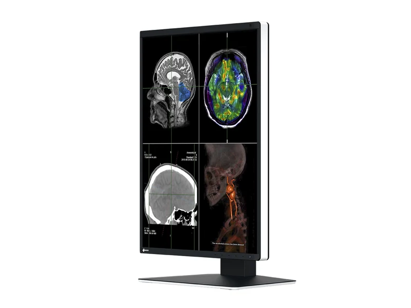 Eizo RadiForce RX370 3MP 21" Color General Radiology Diagnostic PACS Display (RX370)