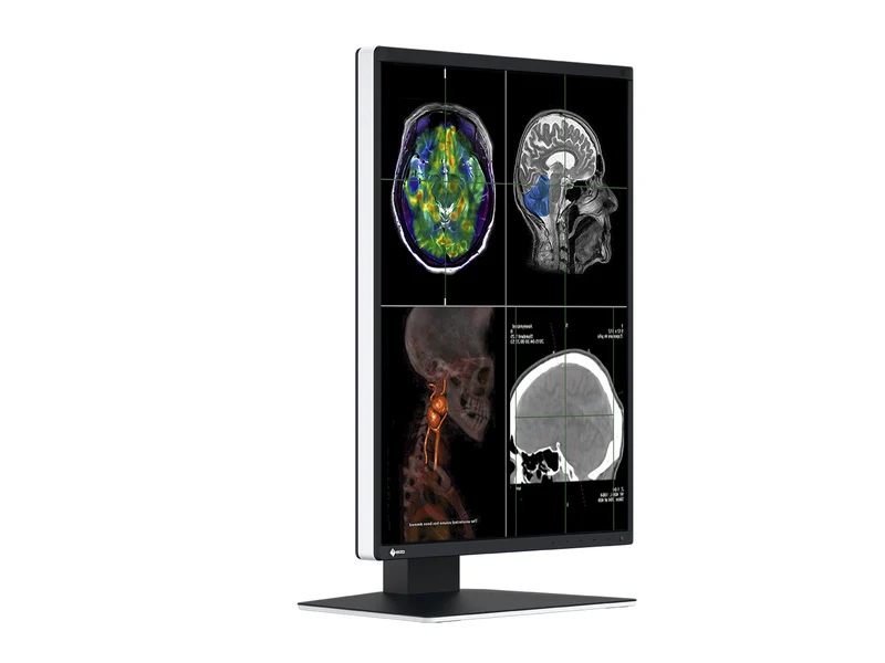 Eizo RadiForce RX370 3MP 21" Color General Radiology Diagnostic PACS Display (RX370)