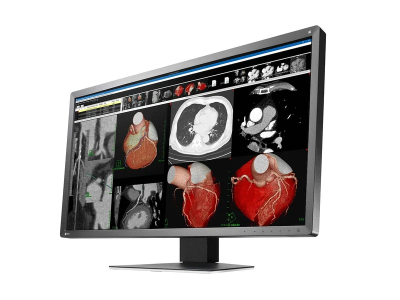 Eizo RadiForce MX317W 8MP 30" Color Clinical Review Display Monitor (MX317W-BK)