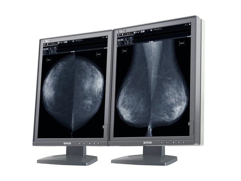 Barco Coronis MDMG-5221 5MP 21" Grayscale Tomosynthesis 3D-DBT Mammography Display