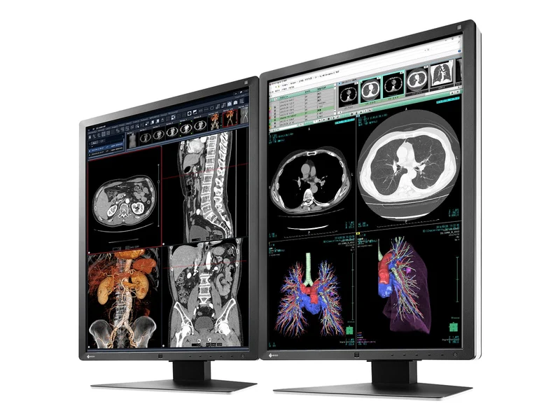 Eizo RadiForce RX250 2MP 21" Color Medical Diagnostic Radiology Display Monitor (RX250-BK)