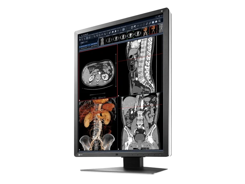 Eizo RadiForce RX250 2MP 21" Color Medical Diagnostic Radiology Display Monitor (RX250-BK)