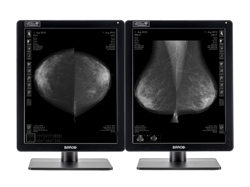 Barco Nio MDNG-6221 5MP 21" Grayscale Mammo 3D-DBT Breast Imaging Display