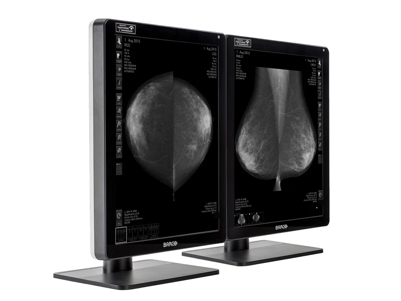Barco Nio MDNG-6221 5MP 21" Grayscale Mammo 3D-DBT Breast Imaging Display
