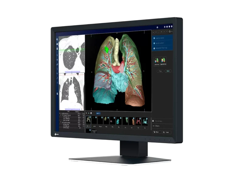 Eizo RadiForce MX243W 2.3MP 24" Color Clinical Review Display (MX243W)