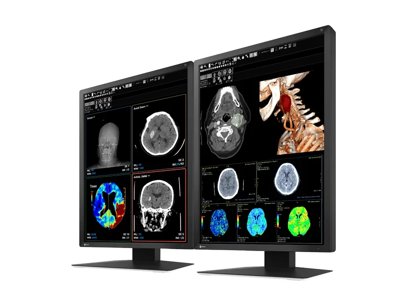Eizo RadiForce MX217 2MP 21" Color Medical Display Monitor (MX217-BK)