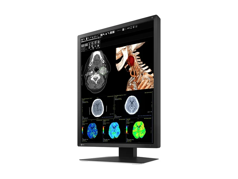 Eizo RadiForce MX217 2MP 21" Color Medical Display Monitor (MX217-BK)