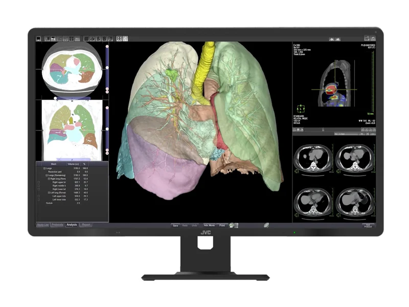 JVC Totoku CL-R813 8MP 32" Color Clinical Review Display Monitor (CL-R813)