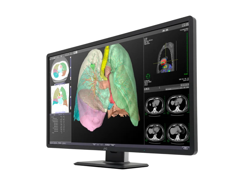 JVC Totoku CL-R813 8MP 32" Color Clinical Review Display Monitor (CL-R813)